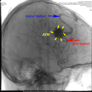 avm kadir tufan